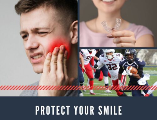 The Importance of Using Mouthguards: Guarding Your Best Smile